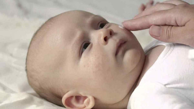 Tips Atasi Infeksi Jamur pada Anak